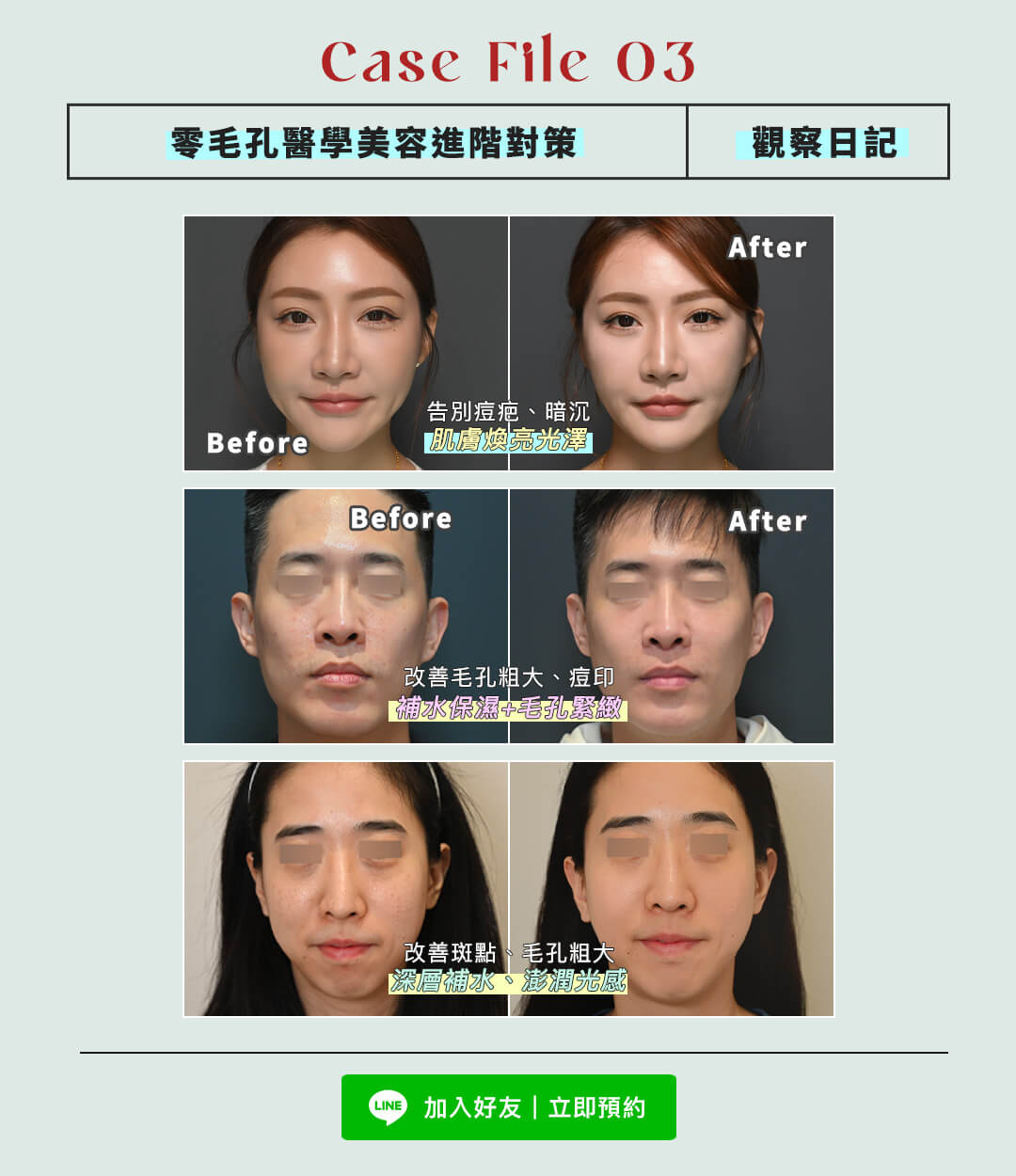 美貌誕生紀實:零毛孔醫學美容進階對策|觀察日記